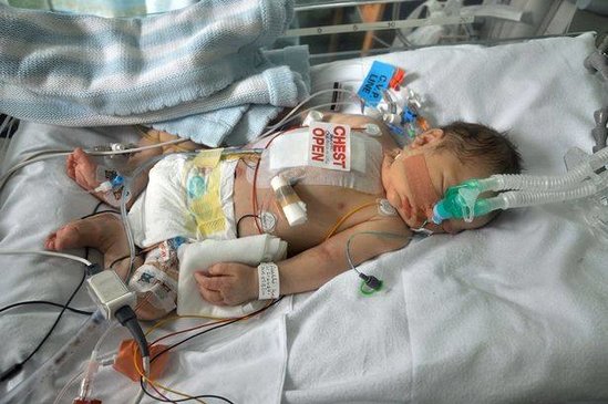 Azərbaycanda 25 günlük körpəni xilas etmək üçün 2 gün vaxt qoyuldu