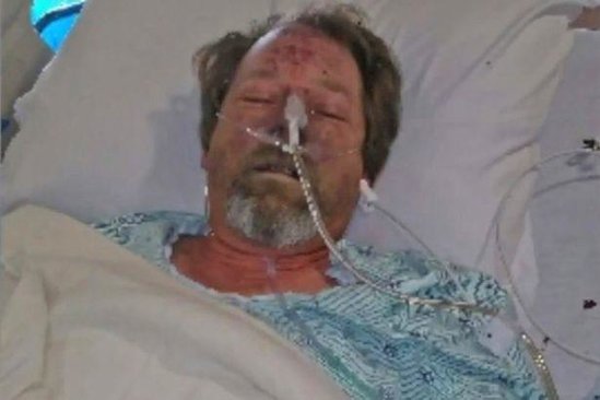 İt sahibini yaladı, kişinin bədəninə infeksiya düşdü, ayaqlarını kəsdilər - FOTO