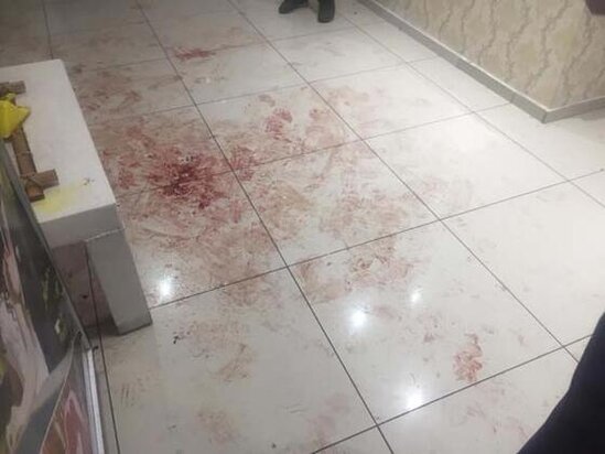 DƏHŞƏTLİ CİNAYƏT: Toy yasa döndü - 16 yaşlı bəyi öldürdülər - FOTO
