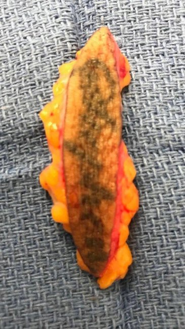 Müğənni ərinə görə dərisini qopartdı - hələ belə hirs çıxaran olmamışdı - FOTO