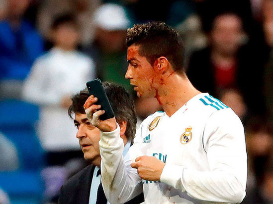 Ronaldonun qaşı yarıldı - "Real Madrid" 7 qolla qalib oldu - VİDEO - FOTO