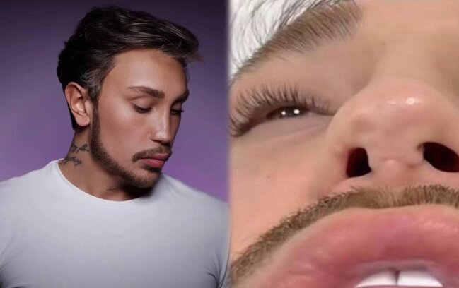 Stilist üç plastik-cərrahdan şikayət etdi: "Burnum çürüdü"