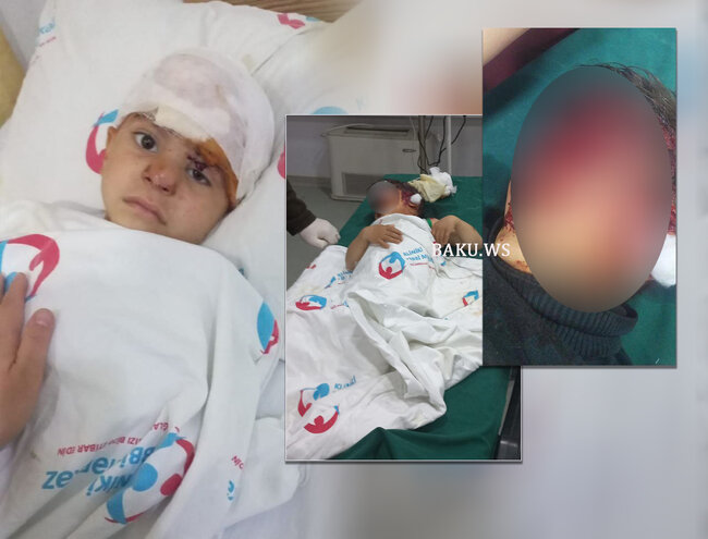 Sahibsiz itlər həyətdə oynayan uşaqlara hücum çəkdilər - İki uşaq ağır xəsarətlər alıb - FOTO