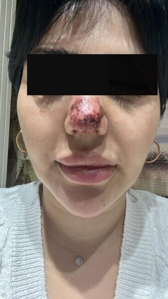 Rəna Soltanovanın daha bir qurbanı danışdı: "İşimdən oldum, külli miqdarda pul itirdim"