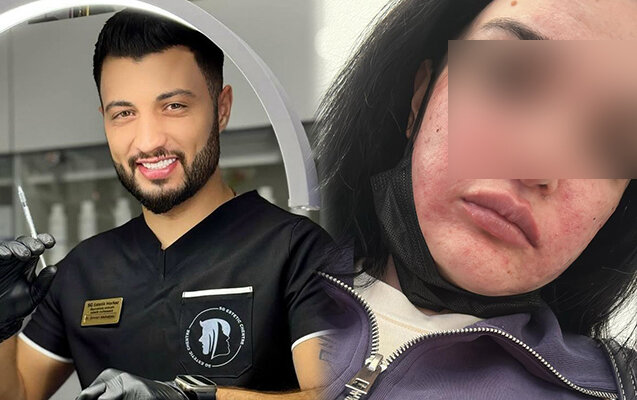 "Prosedurdan sonra mənə dedilər ki, o həkim yox, bərbərdir"