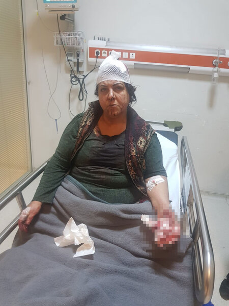 Oğlu ilə birlikdə 86 yaşlı atasını dəyənəklərlə döydü - ANBAAN VİDEO