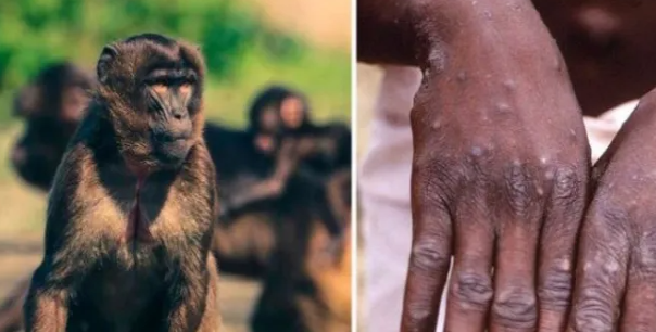 Mutasiyaya uğramış meymun çiçəyi yayılır: ÜST-dən həyəcan təbili