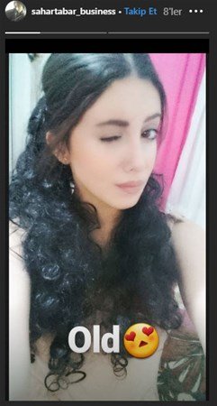 Coliye bənzəmək üçün onlarla əməliyyat etdirən fenomenin 10 il öncəki ŞOK HALI - FOTOLAR