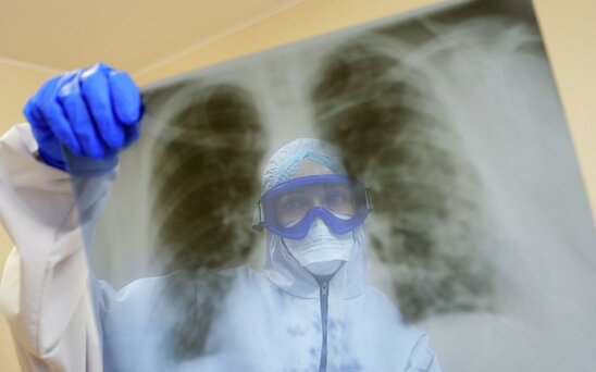 Bronxial astma koronavirusa yoluxma riskini azaldır