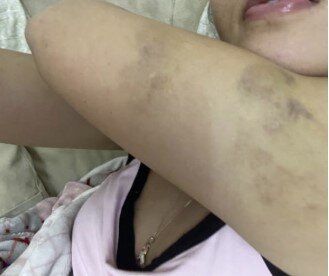 Eks-sevgilisindən Hidayətə ittihamlar - "550 min pulumu ələ keçirib, məni dəfələrlə döyüb"