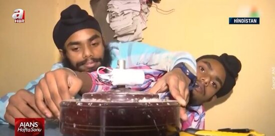 19 yaşlı siyam əkizlərini valideynləri atdı, indi isə onlar... - FOTO