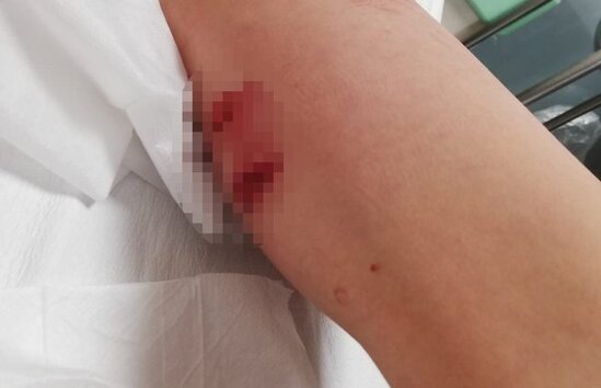 DƏHŞƏT: Daha bir PİTBULL hücumu - ANBAAN VİDEO