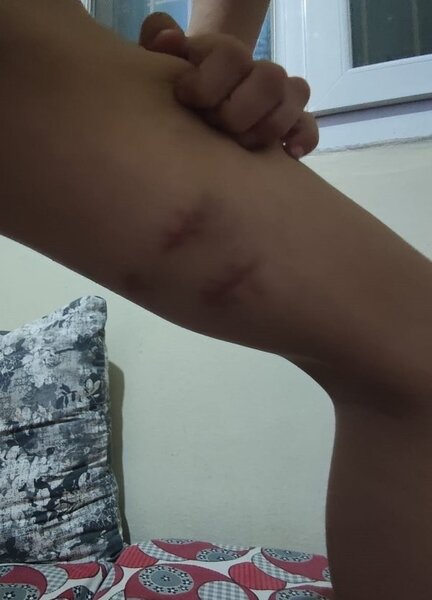 DƏHŞƏT: Daha bir PİTBULL hücumu - ANBAAN VİDEO