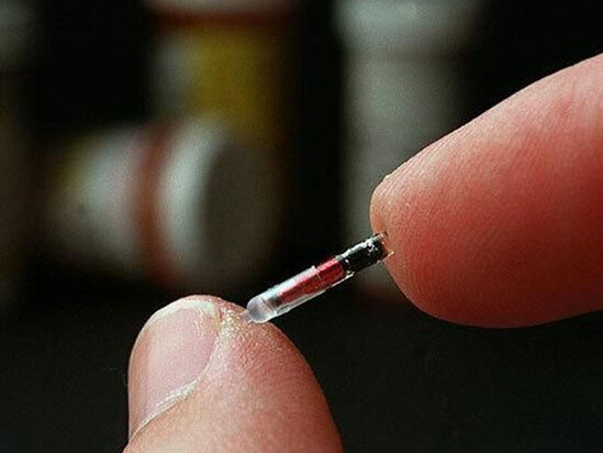 İlk dəfə insana dərialtı çip taxılacaq - Eksperiment