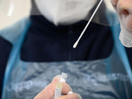 Niyə COVID-19 testinin cavabları gec çıxır? - AÇIQLAMA - VİDEO