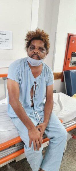 Tanınmış idmançı arvadını maşında əxlaqsızlıq edərkən tutdu - FOTO