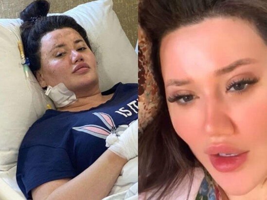 "Allah bu qohumlarımın bəlasını versin" - Aysel - VİDEO