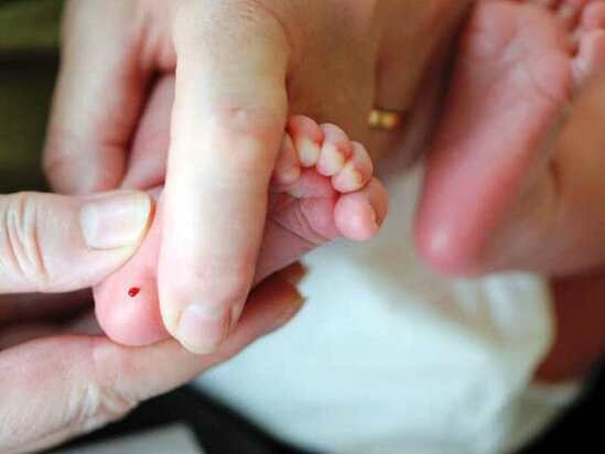 Azərbaycanda körpələrdən topuq testi - götürülürmü?