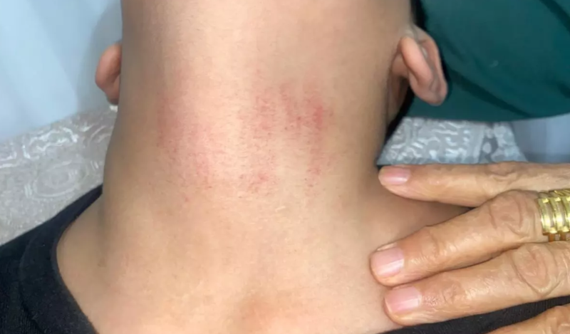 10 yaşlı uşaq məktəbdə bayrağa görə döyülüb? - VİDEO