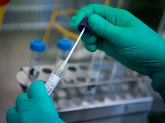 Azərbaycanda koronavirusa yoluxma 150-dən aşağı düşdü: Üç nəfər öldü - FOTO