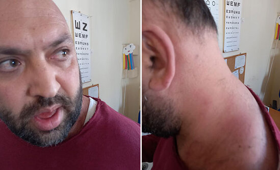 İstədiyi dərmanı yazmayan həkimi döydü - VİDEO