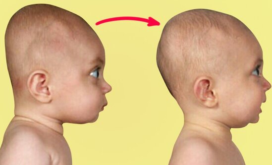 Körpələri bu yersiz müalicələrə məruz qoymayın - Tanınmış pediatrdan MƏSLƏHƏTLƏR