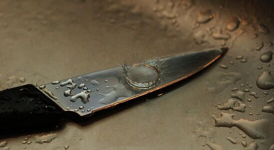 Göygöldə 16 yaşlı qız bıçaq xəsarəti aldı