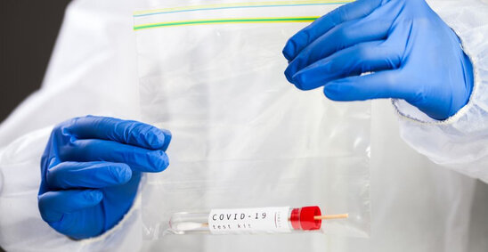 TƏBİB koronavirus testlərinin çatışmazlığı barədə iddialara münasibət bildirib