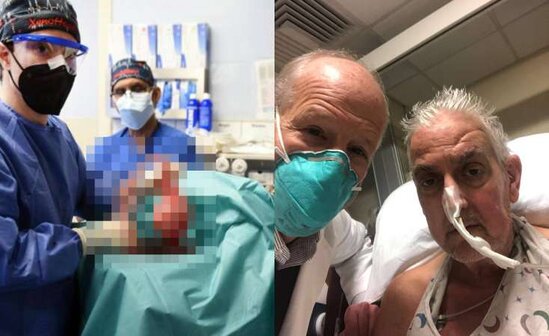 Dünya tibb tarixində İLK YAŞANDI: Donuz ürəyi insana köçürüldü - FOTO