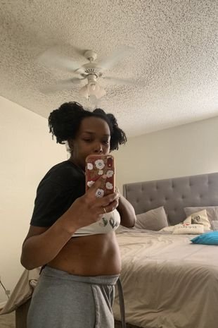 9 ay hamilə olduğundan xəbərsiz olan qadın uşaq dünyaya gətirdi - FOTOLAR