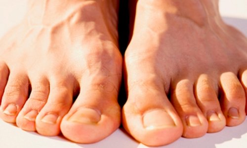 Ayaqda qabar: növləri və müalicə