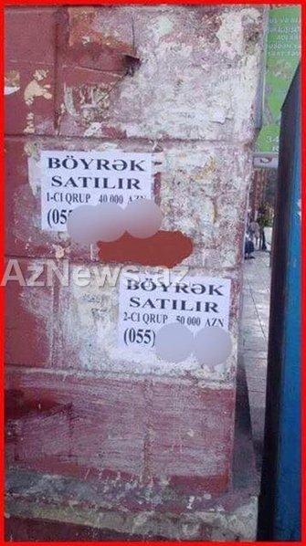Bakıda ŞOK elan - 70 minə böyrək satılır