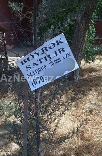 Bakıda ŞOK elan - 70 minə böyrək satılır