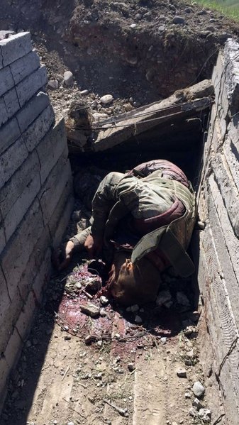 Ermənilərin qoyub qaçdıqları meyitlərin şəkilləri ( +18 )