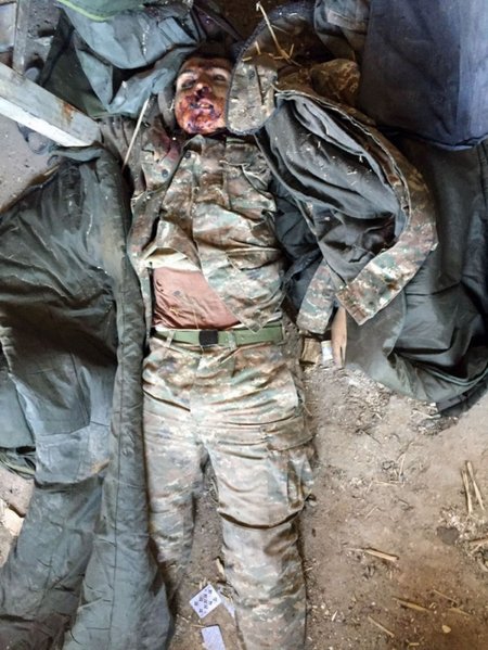 Ermənilərin qoyub qaçdıqları meyitlərin şəkilləri ( +18 )