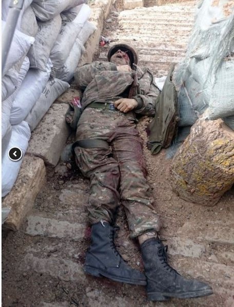 Ermənilərin qoyub qaçdıqları meyitlərin şəkilləri ( +18 )