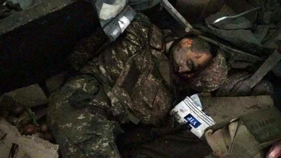 Ermənilərin qoyub qaçdıqları meyitlərin şəkilləri ( +18 )