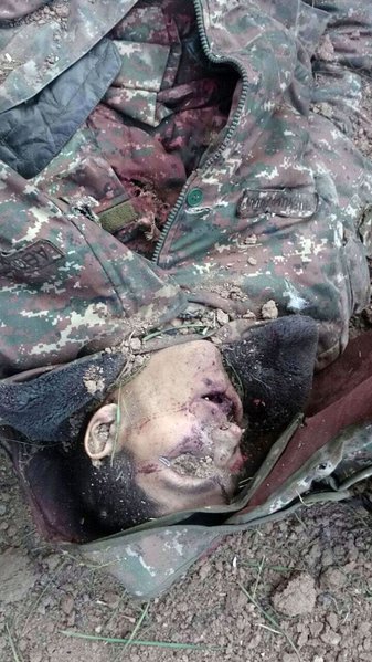 Ermənilərin qoyub qaçdıqları meyitlərin şəkilləri ( +18 )