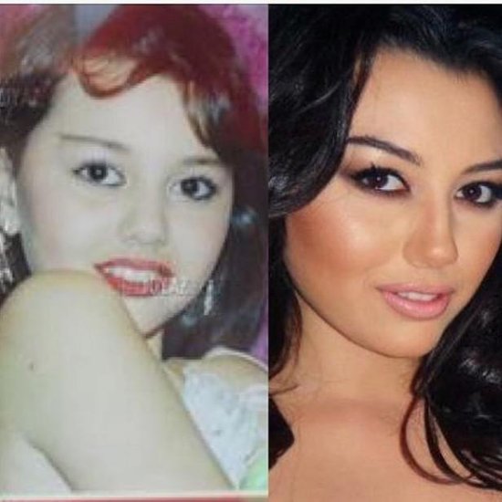 Azərbaycan məşhurları uşaqlıqda və indi - FOTOLAR