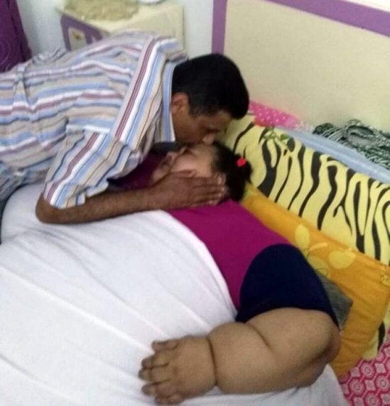 Dünyanın ən kök insanı - 500 kilo çəkisi var - FOTOLAR