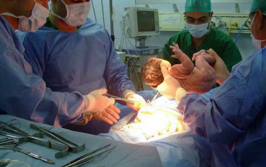 "Anada böyrək çalışmazlığı, qaraciyər sirrozu..." - Azərbaycanda doğuş zamanı ana ÖLDÜ