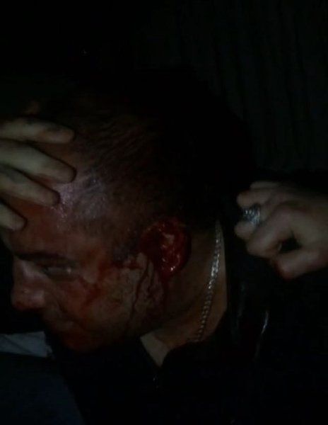 "Lotu Quli"nin adamı -məşhur azərbaycanlı "oğru"nun qulağı kəsildi: DƏHŞƏTLİ FOTOLAR +18