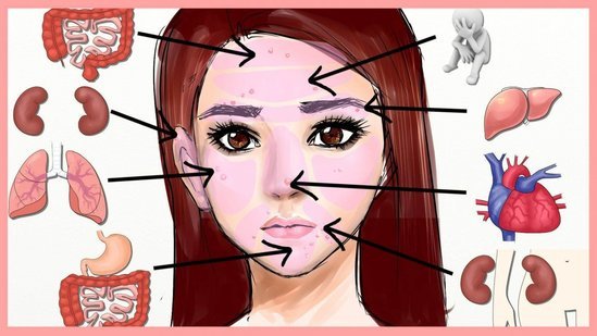 Sizdə qurd xəstəliyinin olamasını bildirən 10 ƏLAMƏT