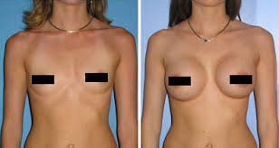 Balaca sinə ölçüsündə olan xanımlar cazibədar görünüşə sahib olacaqsınız