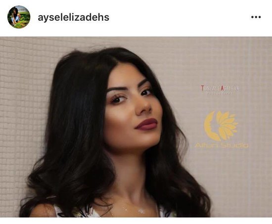 Ermənilərin vəhşicəsinə öldürdüyü 2 yaşlı Zəhranın xəbərinə hansı məşhurlar biganə yanaşdı? - Onları tanıyaq (ADLAR)