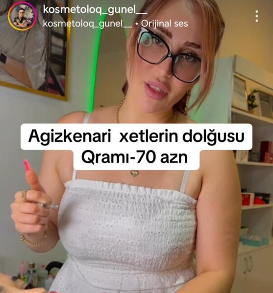 "Kosmetoloq" Günel Muxtar necə inyeksiya prosedurlarını həyata keçirir? -Araşdırma