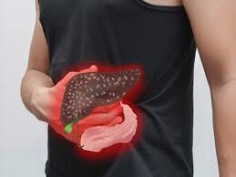 Öddə qatılaşması olanlar və piylənmədən əziyyət çəkənlər bura diqqət!!!