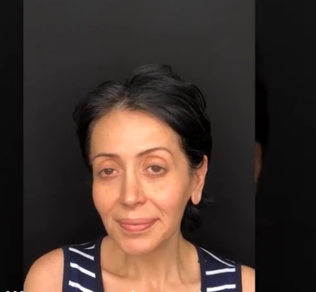 Müğənni Emma Ələkbərzadə tanınmaz halda - VİDEO