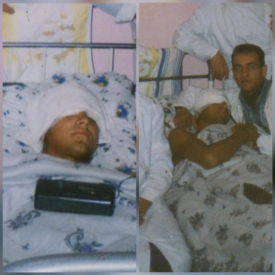 15 gün komada qalmış qazi 20 il əvvəl xəstəxanada çəkilmiş fotosunu paylaşdı - FOTO