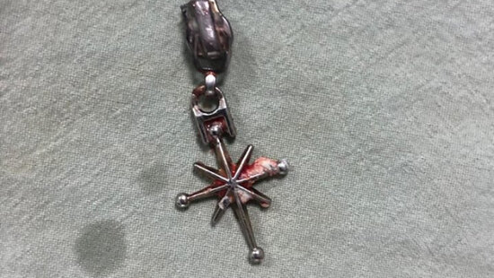 Azərbaycanda körpə zəncirbəndin başlığını uddu - FOTO